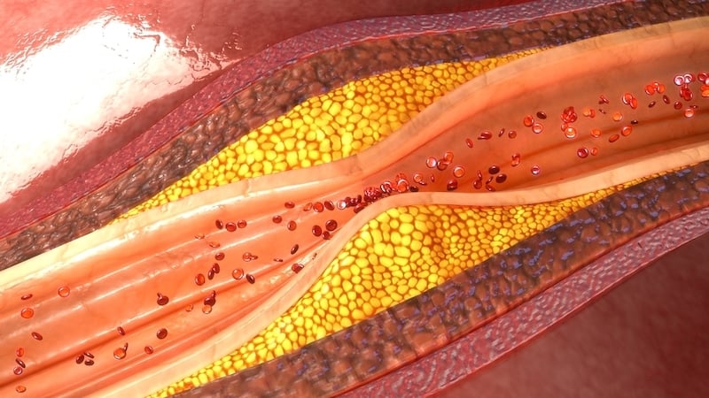 Cholesterol z jablčného octu