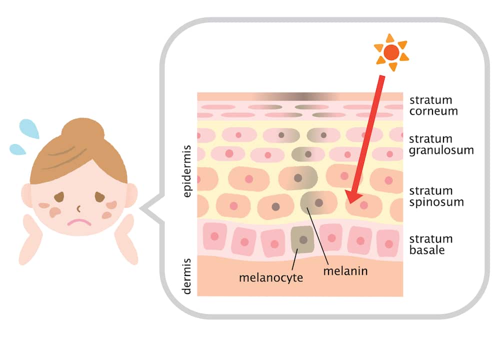 dark spots mechanism illustration