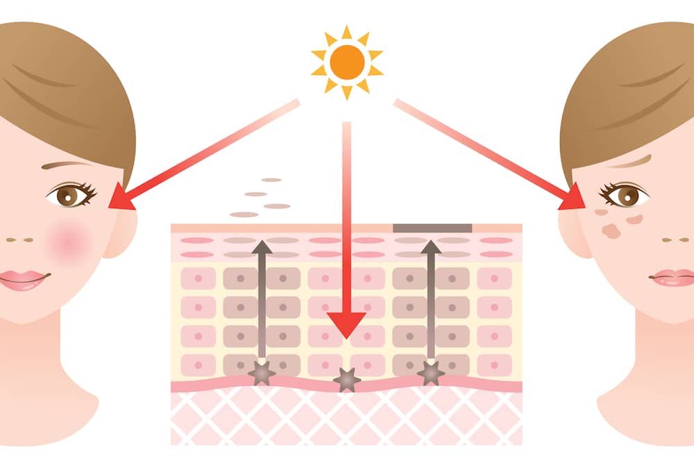 infographic of dark spots