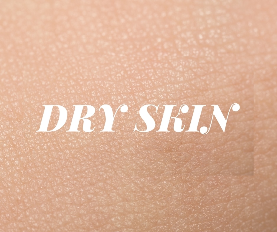 dry skin causes treatments